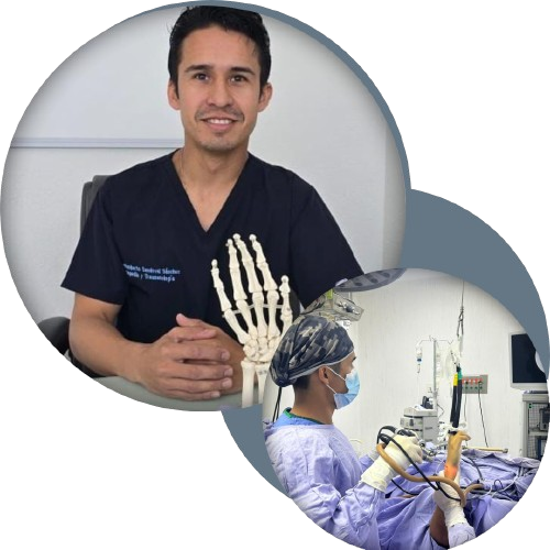 Artroscopía de rodilla en León Guanajuato: Solución Mínimamente Invasiva